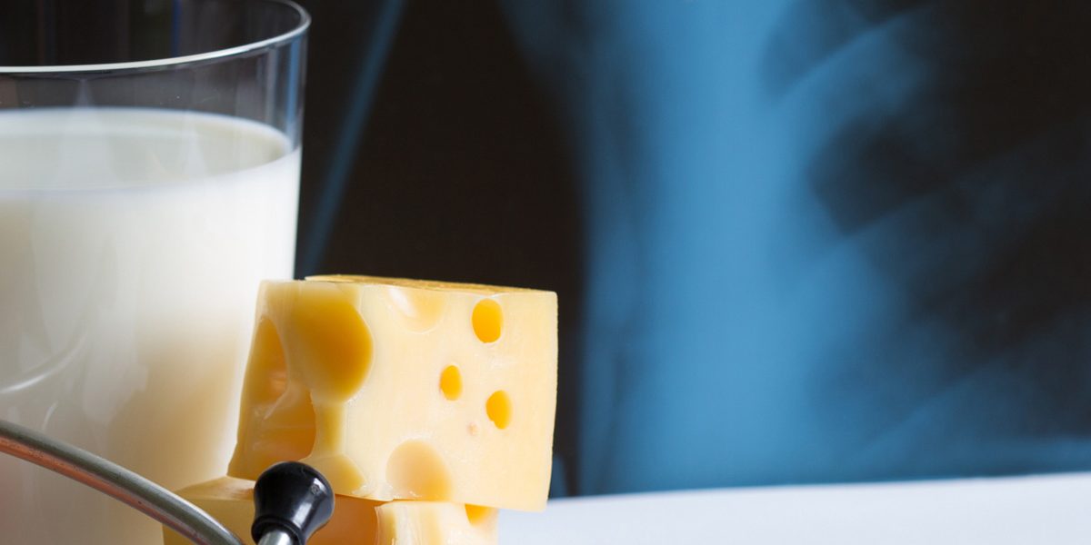 Milk, eggs and cheese. X-ray. Osteoporosis.