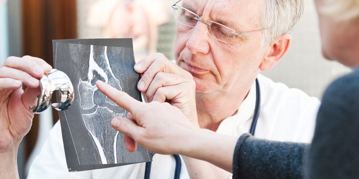 Orthopedic surgeon and patient looking at x-ray and artificial hip