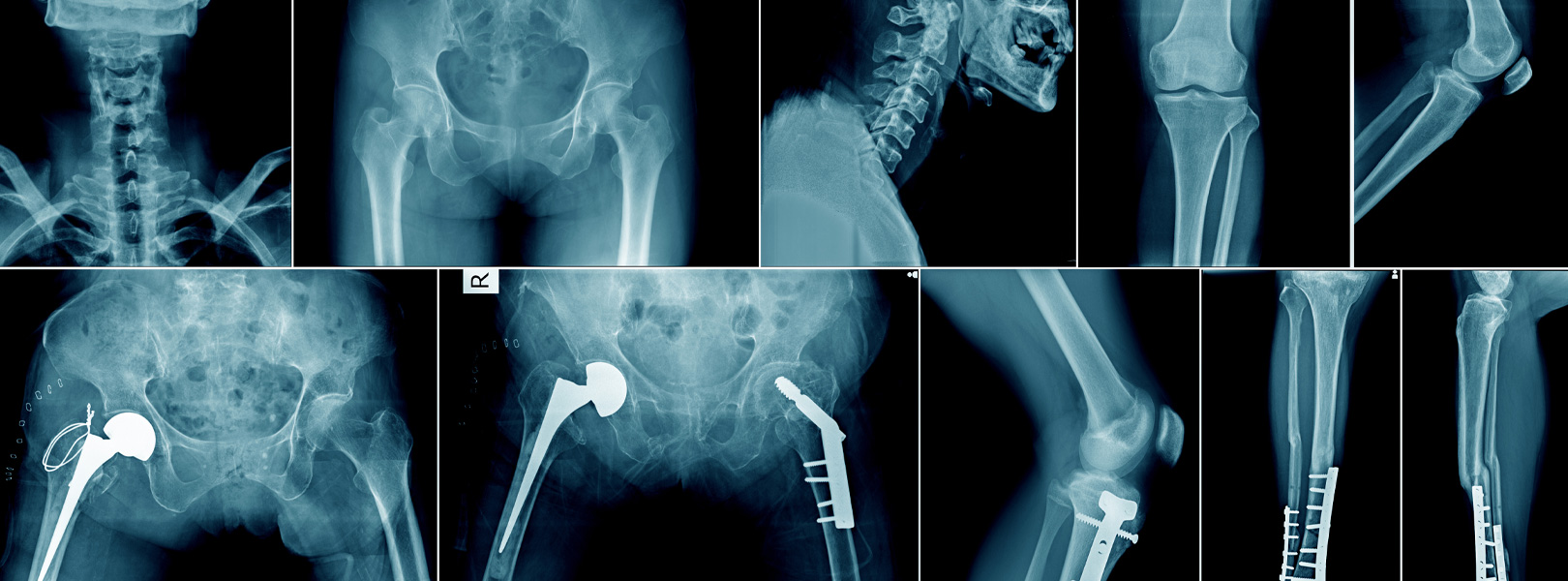 Image displaying multiple x-rays