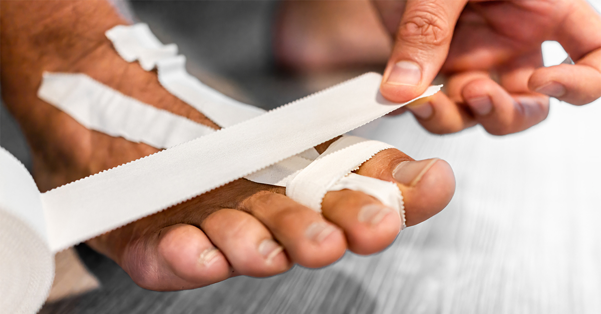 Close up of an individual wrapping their toes with athletic tape