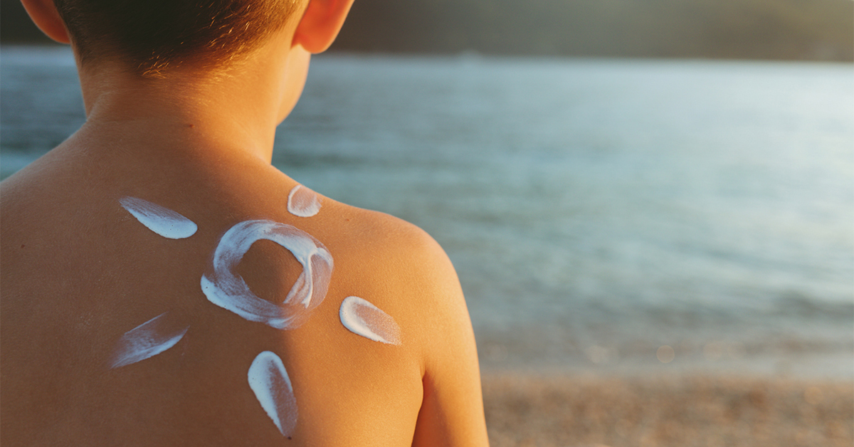 Boy sitting and looking at a lake, thick sunscreen on his back is in the shape of the sun