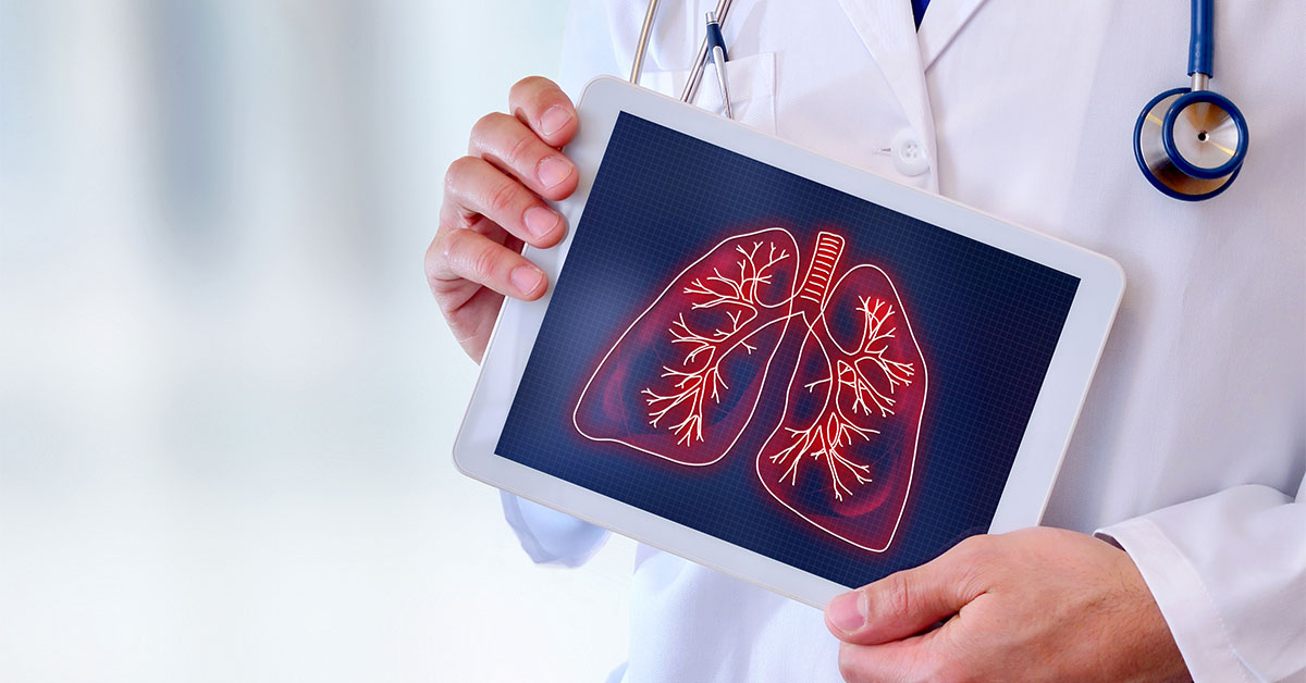Doctor in a lab coat holding a tablet displaying an image of the lungs
