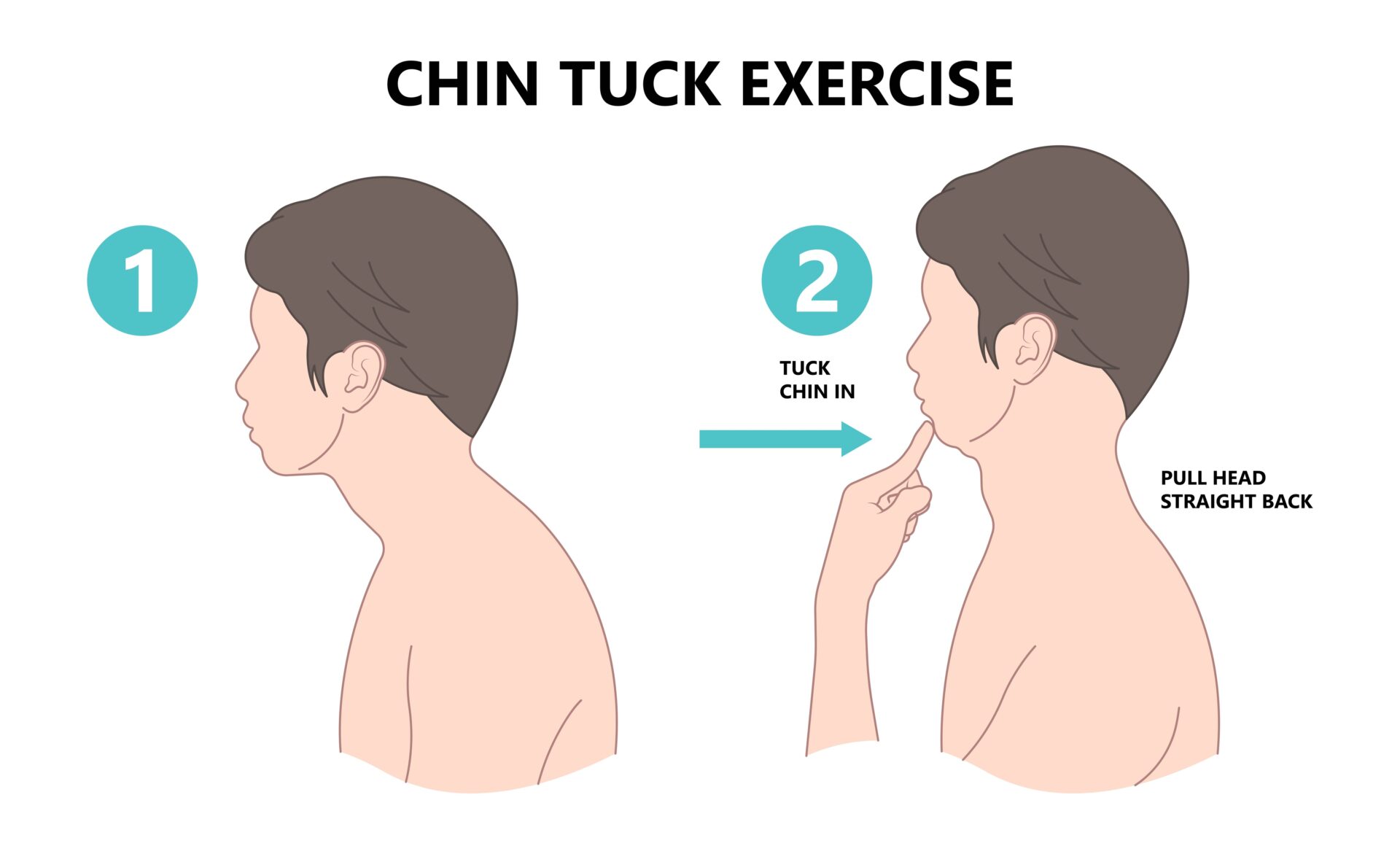 Diagram of Chin Tuck Exercise