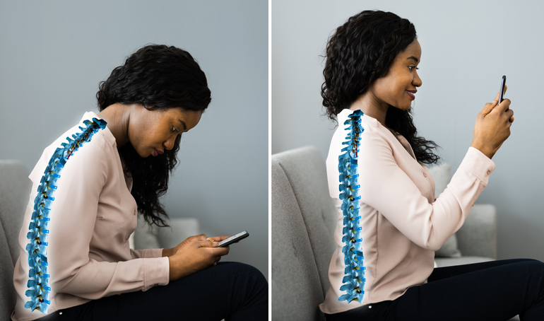 Side by side image of a woman, one with her hunching her shoulders looking down and her phone, the other with her holding her phone up with a straight back